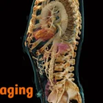 تکنولوژی جدید استفاده از تصاویر سه بعدی در رادیولوژی