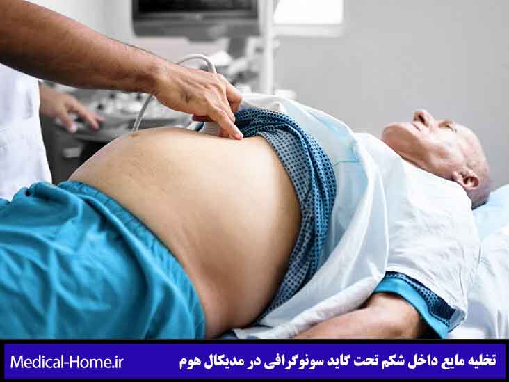 خارج کردن مایع داخل شکم تحت گاید سونوگرافی