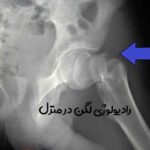 رادیولوژی لگن در منزل تهران
